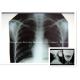 Digital Medical X Ray Dry Film 14 x 17inch Health Imaging Radiographic Film