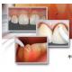 teeth whitening light/dental laser teeth white machine