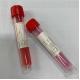 Flocked Naopharyngeal Virus Collect Sampling Tube Medical Disposable