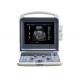 12 Inch LED Portable Ultrasound Scanner Color Doppler 4D Ultrasound Machine