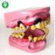 Smoking Tobacco Dental Teeth Model / Smokers ' Teeth Oral Model Pvc Material