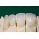 Dental IPS EMax Crown Professional Lithium Disilicate Crown China Dental Lab