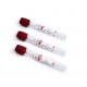 No Additive Plain Red Top Blood Tube 0.5ml-10ml