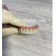 Digital Dental Implant Crown And Bridge High Esthetics Customized