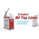 2017 Newest ND Yag Laser Beauty Equipment Laser Tattoo Removal Machine For Pigment Removal