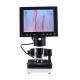 Portable Led Display Nail Fold Capillaroscopy Microscope 400x Magnification