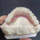 Esthetic Restoration All On 4 Dental Implants Zirconia Hypo Allergenic