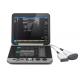 High quality Portable Ultrasound Scanner Device Pltra 6