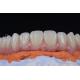 Innovative Minimally Invasive All On 4 All On 6 Dental Implants In 1-2 Weeks
