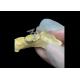 Orthodontic Space maintainer an invaluable device ingeniously guarding children's tooth gaps ensuring proper tooth development.