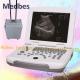 2D pORTABLE Ultrasound Scanner with High Quality