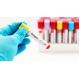 Professional Dengue Ns1 Antigen Test Kit IgG / IgM Antibody Rapid Test Cassette