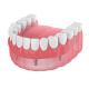 Dentures Missing Teeth Dental Implant Bar Fillings Dentures Temporary Removable Dentures