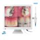 Wireless Wifi Dental Digital Mouthwatch Intraoral Camera 17 Inch LED Monitor