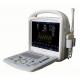 15inch Full-digital Color Doppler Ultrasound System Portable With 3D / 4D Software