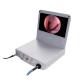 Portable Ccd Ent Endoscope Camera Urology