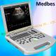 Medical Portable Ultrasound Scanner with Ce ISO