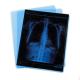 High Contrast Blue Film Medical X Ray Film Printer Compatible With Agfa 5302