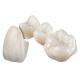 Zirconia Dental Crown: Perfectly Fit, Natural Appearance