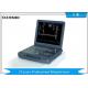Digital Portable Ultrasound Equipment / Small Ultrasound Machine 128 Elements