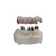 Dental 3D Printed Zirconia Crowns Wear Resistant High Biocompatibility