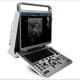 Ergonomic Design Portable Ultrasound Machine Chison EBit 30
