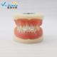 VIC-E15 Teeth Study Model Artificial Physician Certified Tooth Extraction Model