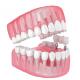 Single All Ceramic Teeth Dental Implants Missing Filling Dentures Wisdom Teeth