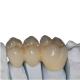OEM Customized Zirconia Porcelain Teeth High Strength Durable Beautiful