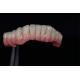 High Success Rate All On Four All On Six  Zirconia Titanium Dental Implants Customized