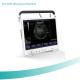 15”LCD with high resolution Two USB ports B/W ultrasound scanner for human or vet