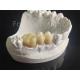 Wear Resistance Zirconia Layered With Porcelain Dental Material