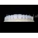Customized Natural Porcelain Veneers Dental Lab Veneers Stain Resistant